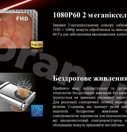 Гастростійка, ендоскопічна стійка для колоноскопії, стійка для бронхоскопії